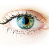 Transplantacia rohovky je moderný zákrok, ktorý vám navráti váš zdravý zrak.